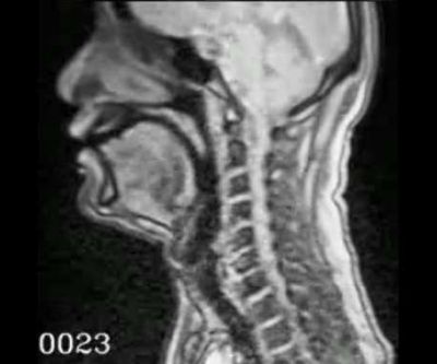 Example of real-time MRI images